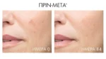 Vichy Liftactiv Pigment Specialist B3 Serum - Αντιγηραντικός Ορός Προσώπου Ενάντια στις Κηλίδες 30ml - Image 5